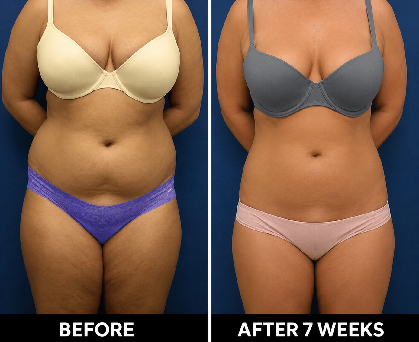 Red Light Therapy Slimming Belt | Tone, Shape & Relax