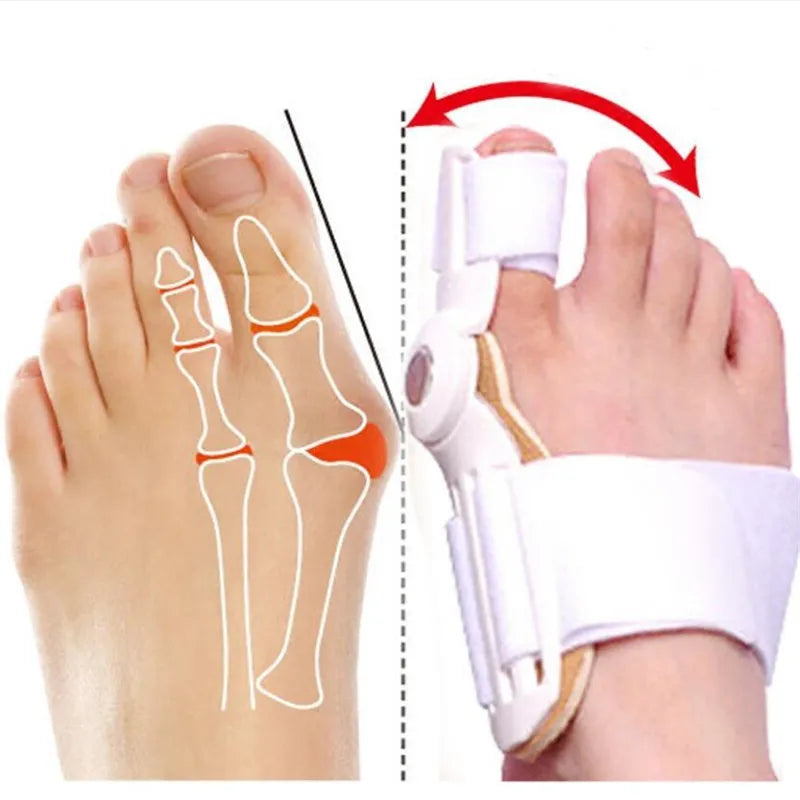 Orthopaedic Big Toe Corrector