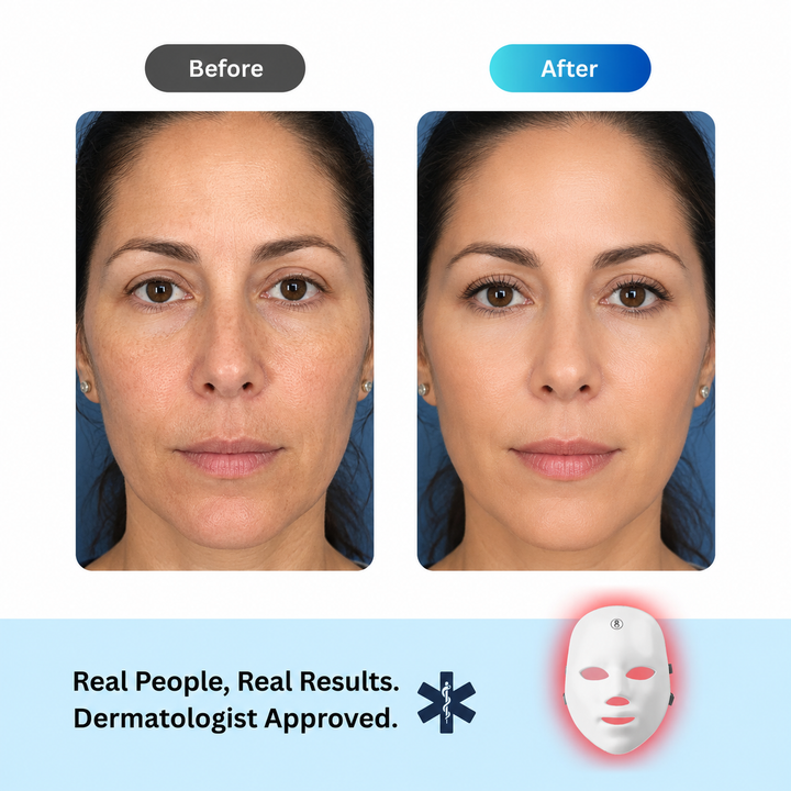 Glowing Skin Red Light LED Mask Bonus (Neck Red Light Strip)