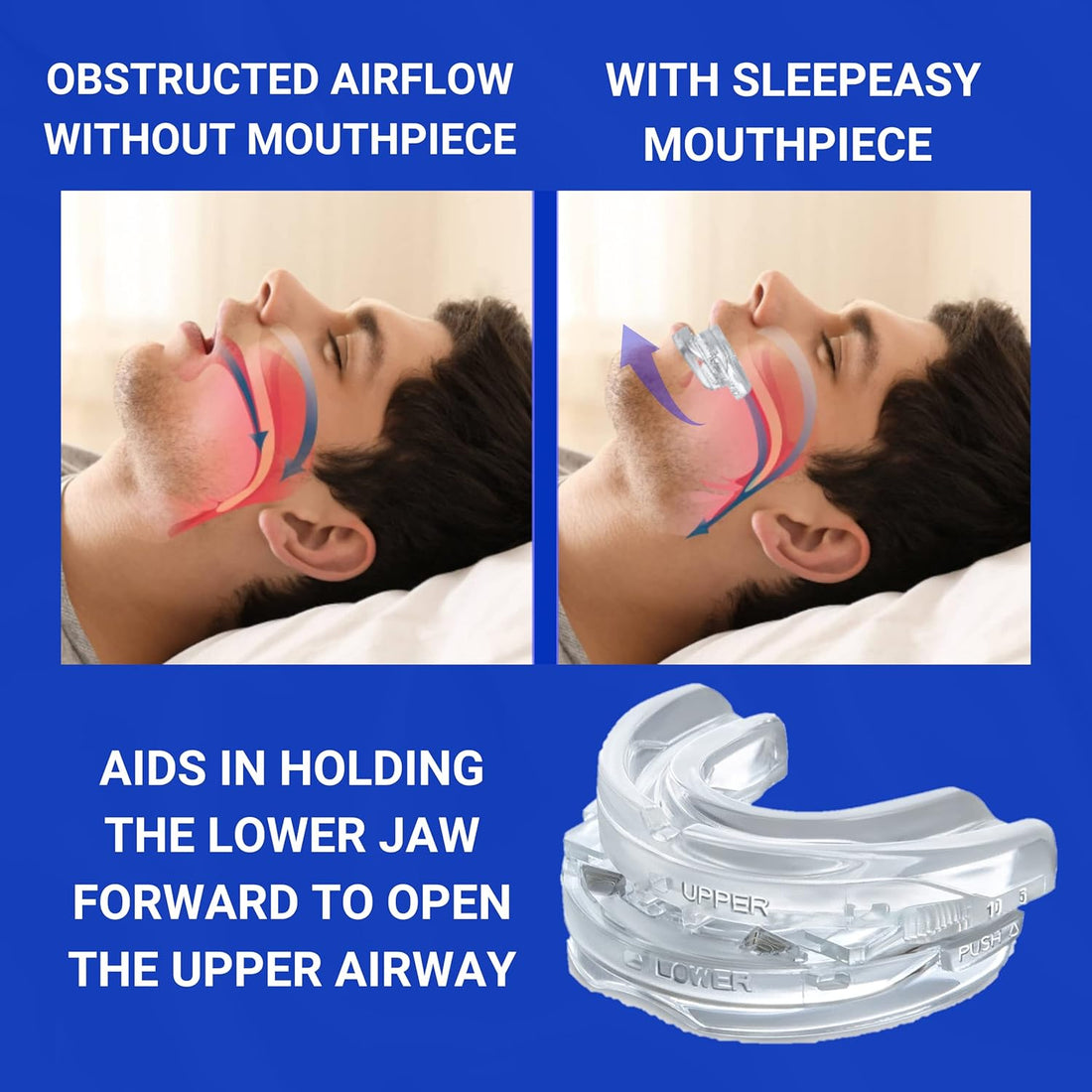 Silent Sleep Mouth Guard Anti Snoring